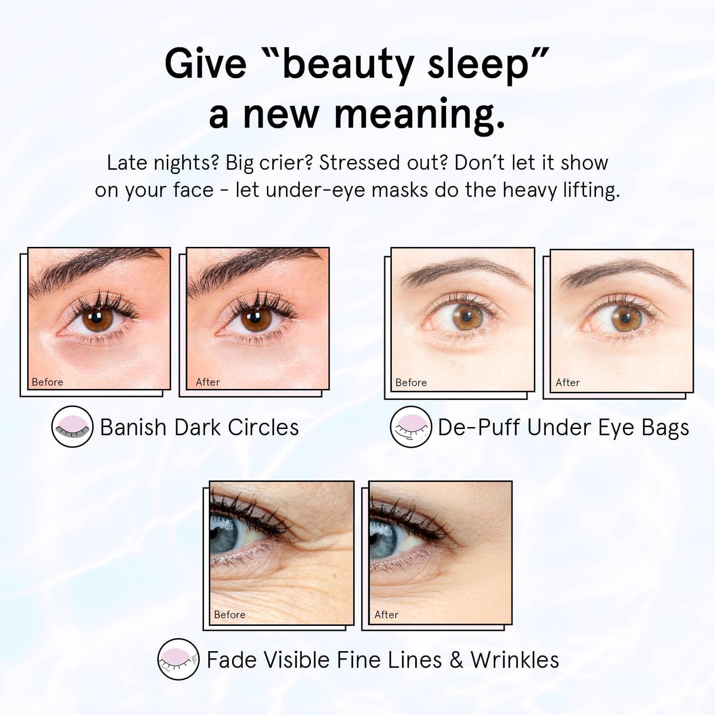 grace & stella Under Eye Patches (12 pairs) Eye Masks for Dark Circles and Puffiness
