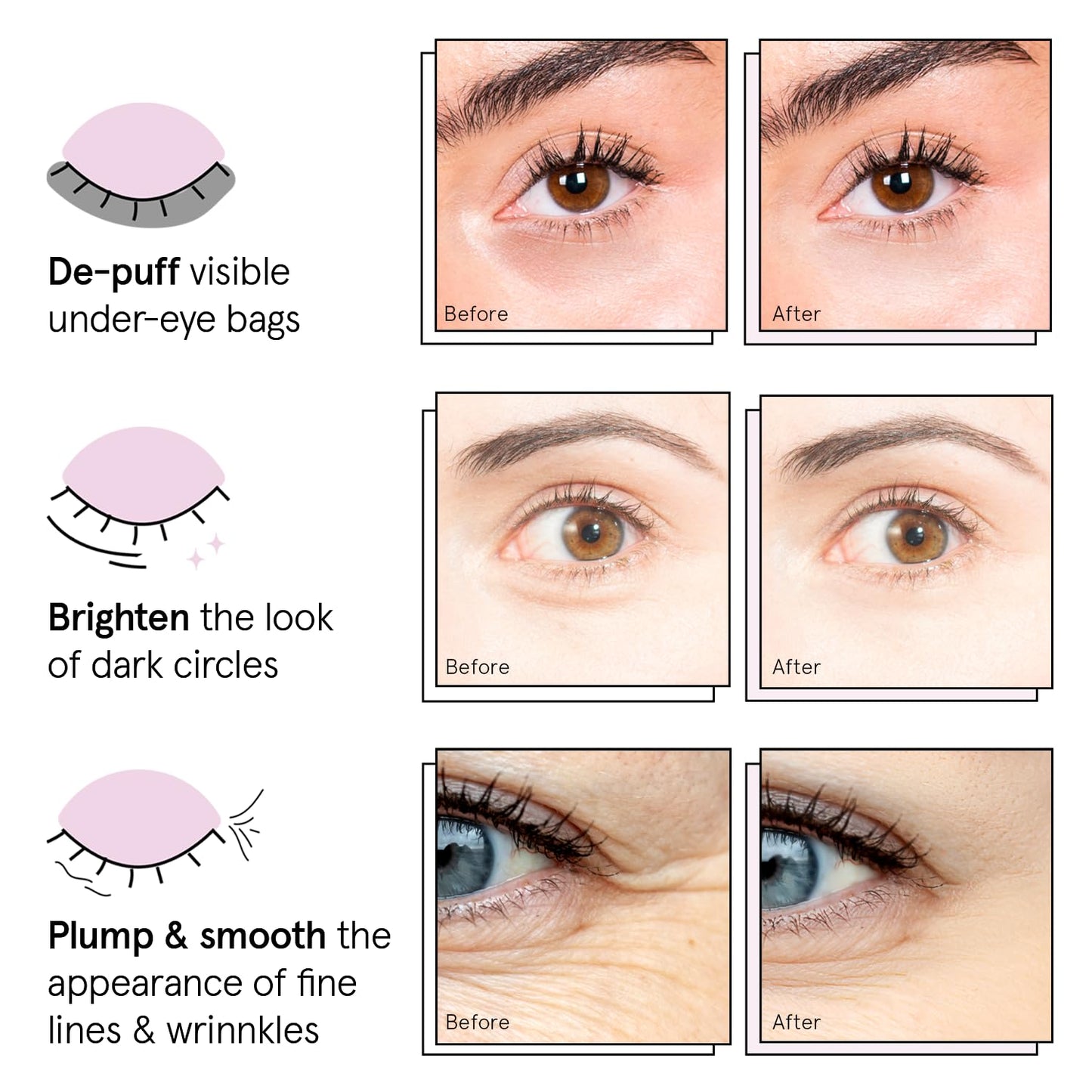 grace & stella Under Eye Patches (12 pairs) Eye Masks for Dark Circles and Puffiness
