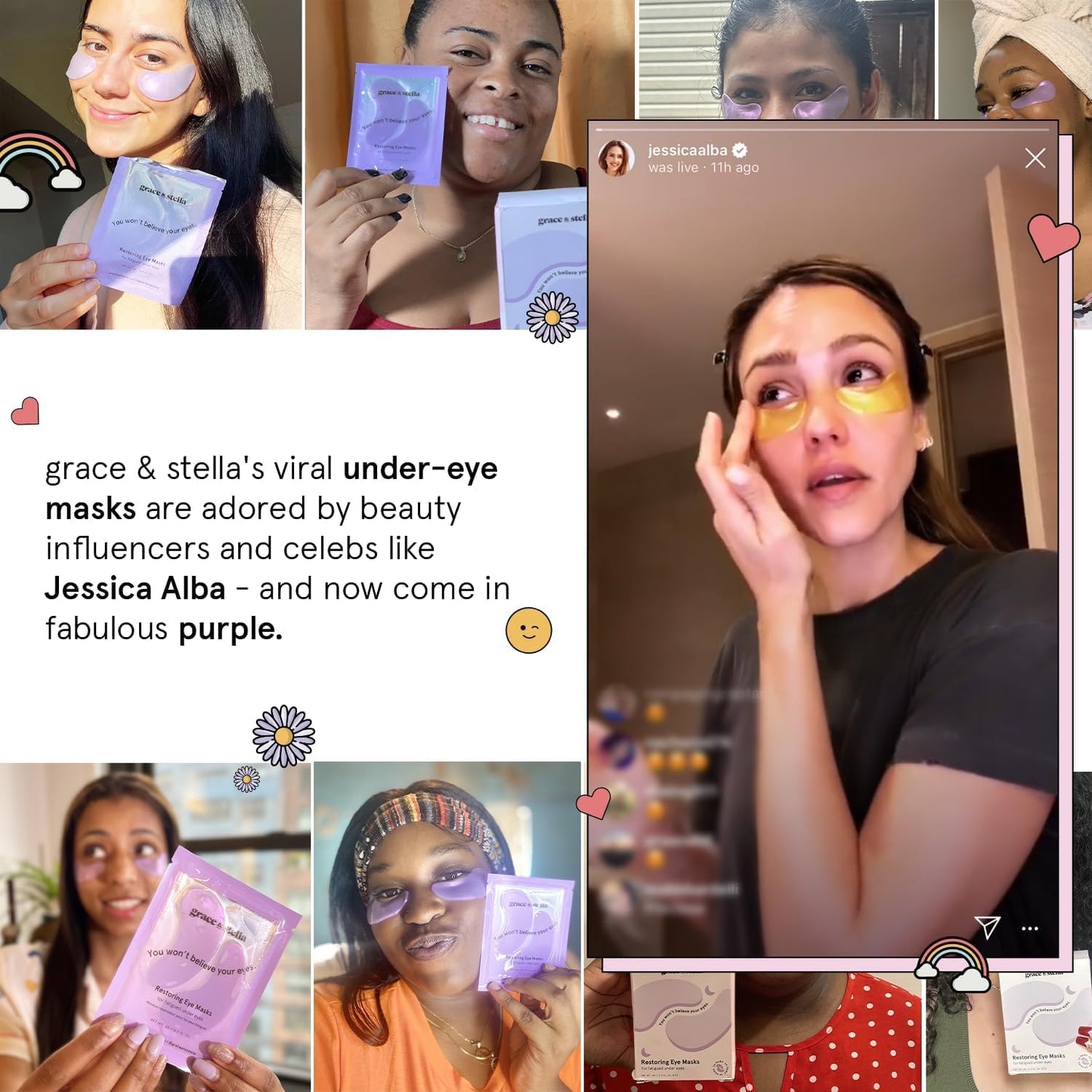 grace & stella Under Eye Patches (12 pairs) Eye Masks for Dark Circles and Puffiness